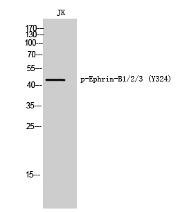 Fig. Western Blot analysis of JK cells using Phospho-Ephrin-B1/2/3 (Y324) Polyclonal Antibody.