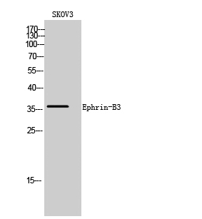 Fig. Western Blot analysis of SKOV3 cells using Ephrin-B3 Polyclonal Antibody.