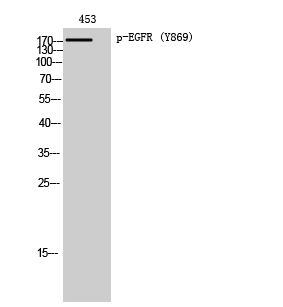 Fig. Western Blot analysis of 453 cells using Phospho-EGFR (Y869) Polyclonal Antibody diluted at 1:1000.
