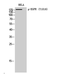 Fig. Western Blot analysis of HELA cells using Phospho-EGFR (Y1016) Polyclonal Antibody diluted at 1:1000.