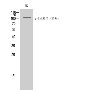 Fig. Western Blot analysis of JK cells using Phospho-EphA2/5 (Y594) Polyclonal Antibody.