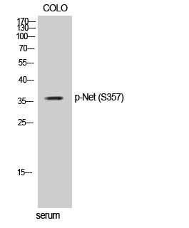 Fig. Western Blot analysis of COLO cells using Phospho-Net (S357) Polyclonal Antibody.