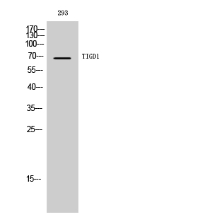 Fig. Western Blot analysis of 293 cells using TIGD1 Polyclonal Antibody diluted at 1:500. Secondary antibody (catalog#: A21020) was diluted at 1:20000.