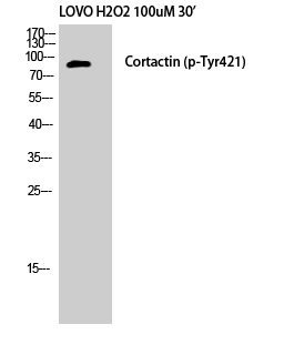 Fig. Western Blot analysis of LOVO+H2O2 cells using Phospho-Cortactin (Y421) Polyclonal Antibody.