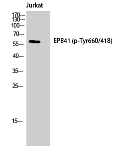 Fig.2. Western Blot analysis of Jurkat cells using Phospho-4.1R (Y660) Polyclonal Antibody.