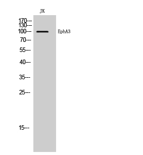 Fig. Western Blot analysis of JK cells using EphA3 Polyclonal Antibody.