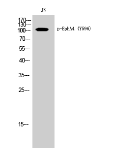 Fig. Western Blot analysis of JK cells using Phospho-EphA4 (Y596) Polyclonal Antibody.
