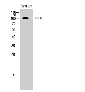 Fig. Western Blot analysis of 293T-UV cells using EphA7 Polyclonal Antibody diluted at 1:500.