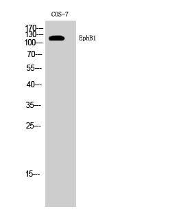 Fig. Western Blot analysis of COS-7 cells using EphB1 Polyclonal Antibody diluted at 1:1000.