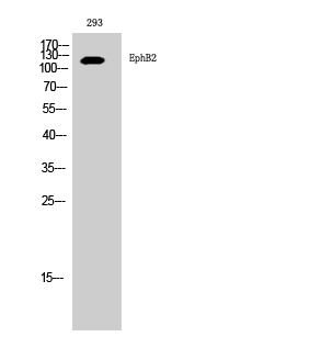 Fig. Western Blot analysis of 293 cells using EphB2 Polyclonal Antibody diluted at 1:1000.