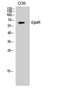 Fig. Western Blot analysis of HepG2 cells using EpoR Polyclonal Antibody.