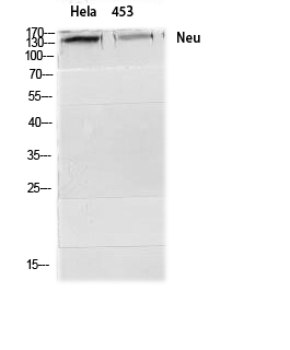 Fig.2. Western Blot analysis of Hela 453 cells using Neu Polyclonal Antibody diluted at 1:2000.