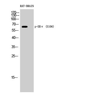 Fig. Western Blot analysis of RAT-BRAIN cells using Phospho-ERα (S106) Polyclonal Antibody diluted at 1:500.