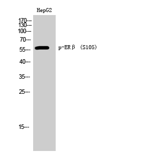 Fig. Western Blot analysis of HepG2 cells using Phospho-ERβ (S105) Polyclonal Antibody.
