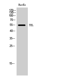 Fig. Western Blot analysis of HuvEc cells using TEL Polyclonal Antibody.