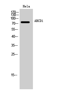 Fig. Western Blot analysis of Hela cells using ABCD1 Polyclonal Antibody.
