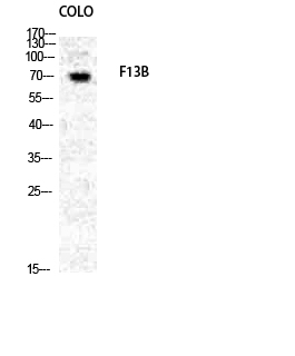 Fig. Western Blot analysis of COLO cells using Factor XIII B Polyclonal Antibody diluted at 1:1000.