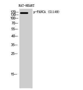 Fig. Western Blot analysis of RAT-HEART cells using Phospho-FANCA (S1149) Polyclonal Antibody diluted at 1:500.
