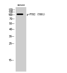 Fig. Western Blot analysis of Mouse cells using Phospho-PYK2 (Y881) Polyclonal Antibody.