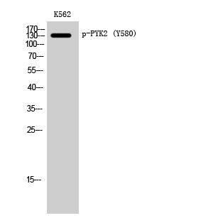 Fig. Western Blot analysis of K562 cells using Phospho-PYK2 (Y580) Polyclonal Antibody.