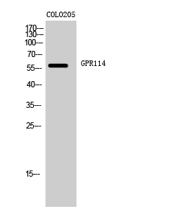 Fig. Western Blot analysis of COLO205 cells using GPR114 Polyclonal Antibody.