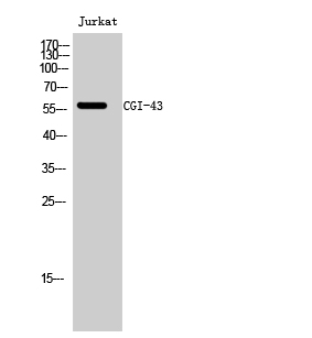 Fig. Western Blot analysis of Jurkat cells using CGI-43 Polyclonal Antibody diluted at 1:500.