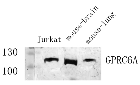 Fig.2. Western Blot analysis of various cells using Antibody diluted at 1:1000. Secondary antibody (catalog#: A21020) was diluted at 1:20000.