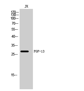 Fig. Western Blot analysis of JK cells using FGF-13 Polyclonal Antibody diluted at 1:500.