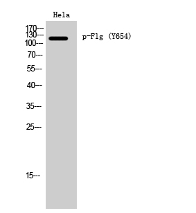 Fig. Western Blot analysis of Hela cells using Phospho-Flg (Y654) Polyclonal Antibody diluted at 1:1000.