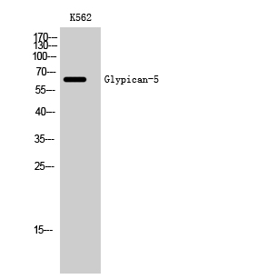 Fig. Western Blot analysis of K562 cells using Glypican-5 Polyclonal Antibody.