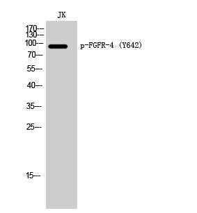 Fig. Western Blot analysis of JK cells using Phospho-FGFR-4 (Y642) Polyclonal Antibody.