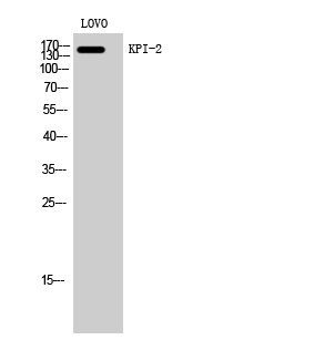 Fig. Western Blot analysis of LOVO cells using KPI-2 Polyclonal Antibody.