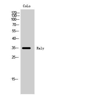 Fig. Western Blot analysis of CoLo cells using Raly Polyclonal Antibody.