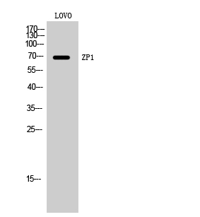 Fig. Western Blot analysis of LOVO cells using ZP1 Polyclonal Antibody. Secondary antibody (catalog#: A21020) was diluted at 1:20000.