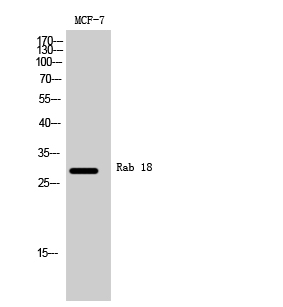 Fig. Western Blot analysis of MCF-7 cells using Rab 18 Polyclonal Antibody.