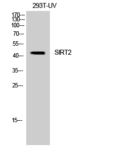 Fig. Western Blot analysis of 293 cells using SIRT2 Polyclonal Antibody diluted at 1:1000.
