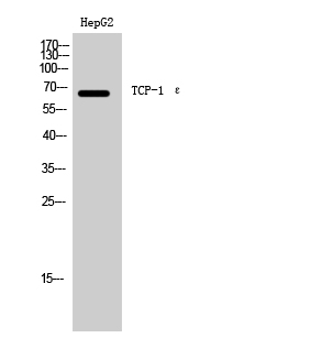 Fig. Western Blot analysis of HepG2 cells using TCP-1 ε Polyclonal Antibody.