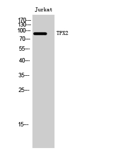 Fig. Western Blot analysis of Jurkat cells using TPX2 Polyclonal Antibody. Secondary antibody (catalog#: A21020) was diluted at 1:20000.