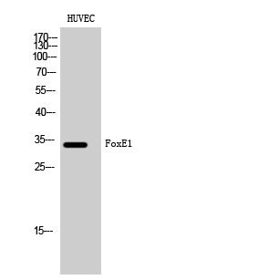 Fig. Western Blot analysis of HUVEC cells using FoxE1 Polyclonal Antibody.