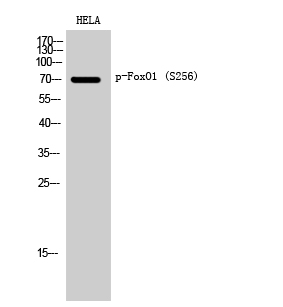 Fig. Western Blot analysis of HELA cells using Phospho-FoxO1 (S256) Polyclonal Antibody diluted at 1:1000.