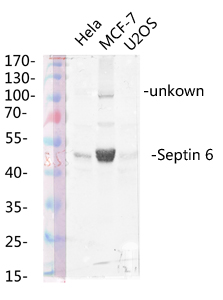 Fig.2. Western blot analysis of various lysis using Septin 6 Polyclonal Antibody diluted at 1:1000. Secondary antibody (catalog#: A21020) was diluted at 1:20000.
