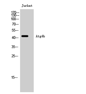 Fig. Western Blot analysis of Jurkat cells using Atg4b Polyclonal Antibody.