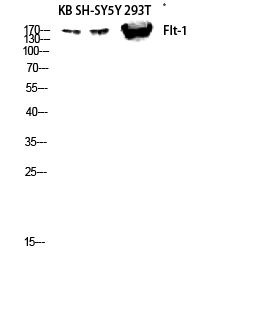 Fig.1. Western blot analysis of KB SH-SY5Y 293T lysis using Flt-1 antibody. Antibody was diluted at 1:1000.