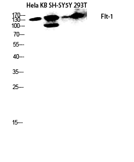 Fig.2. Western blot analysis of Hela KB SH-SY5Y 293T lysis using Flt-1 antibody. Antibody was diluted at 1:1000.