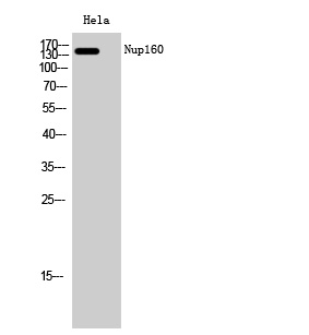 Fig. Western Blot analysis of Hela cells using Nup160 Polyclonal Antibody diluted at 1:2000.