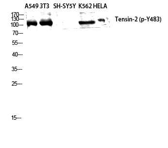 Fig.2. Western Blot analysis of A549 NIH-3T3 SH-SY5Y K562 HELA cells using Phospho-Tensin-2 (Y483) Polyclonal Antibody diluted at 1:2000.