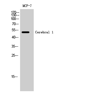 Fig. Western Blot analysis of MCF-7 cells using Cerebral 1 Polyclonal Antibody.
