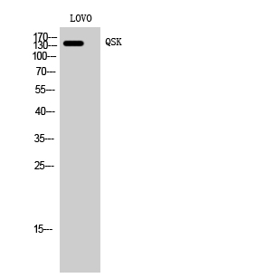 Fig. Western Blot analysis of LOVO cells using QSK Polyclonal Antibody.