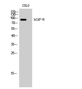 Fig. Western Blot analysis of COLO cells using hCAP-H Polyclonal Antibody.