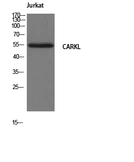 Fig. Western Blot analysis of Jurkat cells using CARKL Polyclonal Antibody.